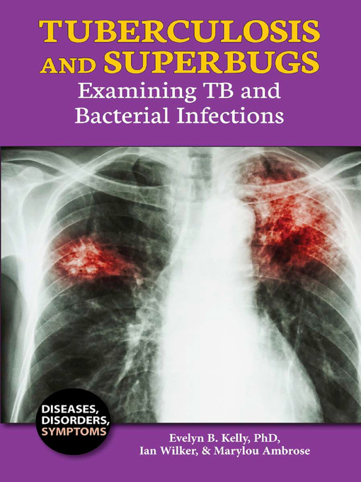 Title details for Tuberculosis and Superbugs by Evelyn B. Kelly, PhD - Wait list